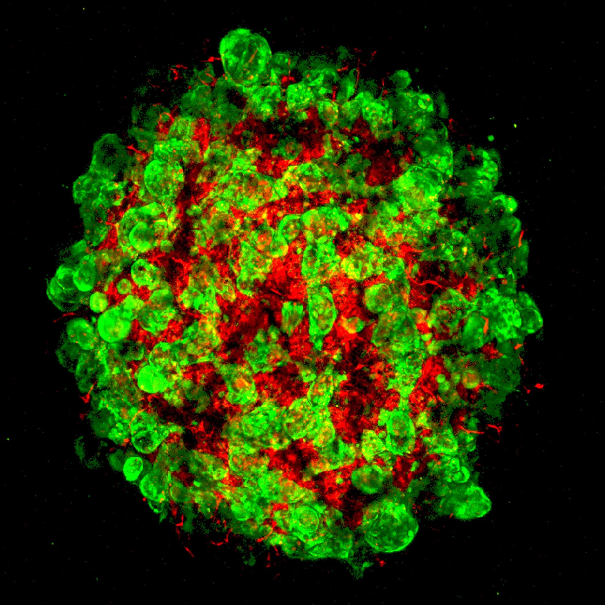 Клетки печени в крови. Стволовые клетки печени. Печеночно-клеточная аденома. Зелёная печень фитонциды. Pluripotent Stem Cells image.