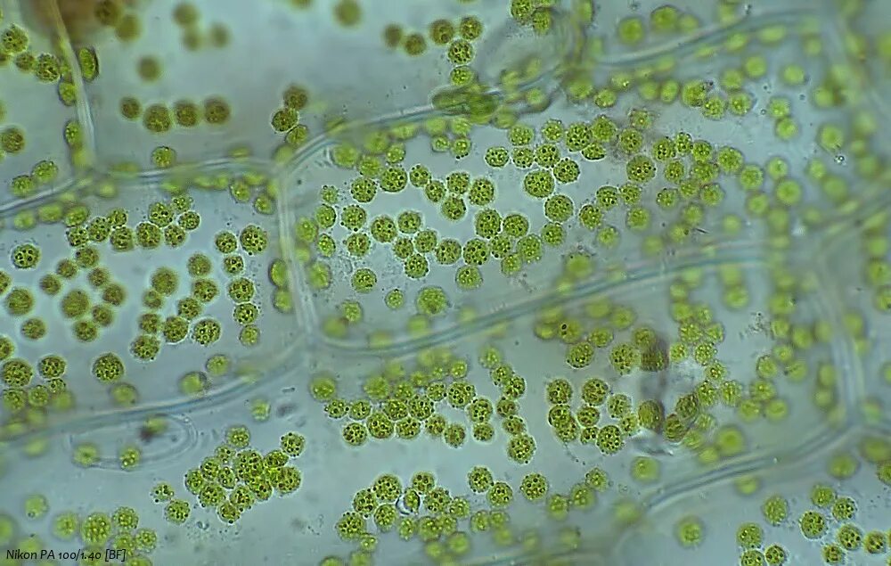 Клетки рябины под микроскопом