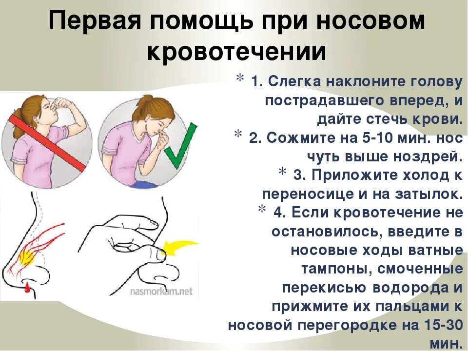 При массовом кровотечении. Остановка родового кровотечения. Как Остановить кровб из роса. Как Остановить кровь из носа.