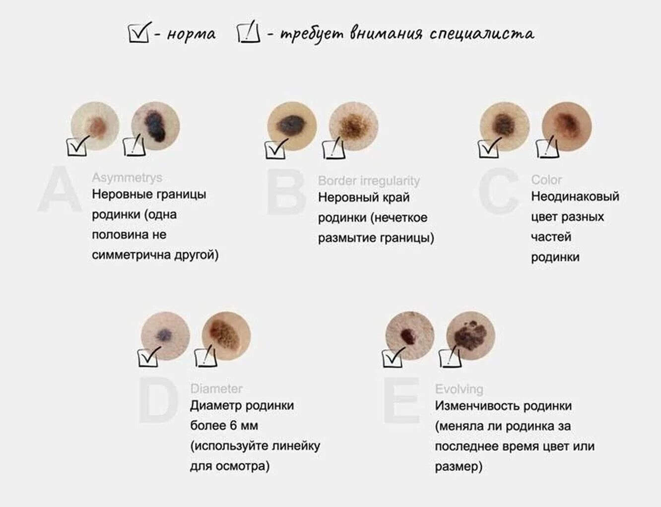 Почему появилось множество. Нормальный цвет родинки.