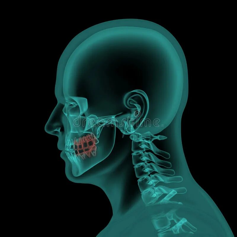 Голова головной мозг шея. Рентгенография головы и шеи. Рентген человеческой головы.