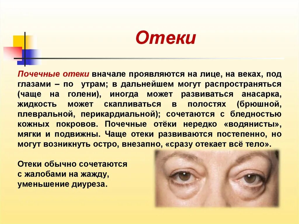 Что может быть из. Почетные отёки на лице. Почечные отеки под глазами. Почечные отеки проявления.