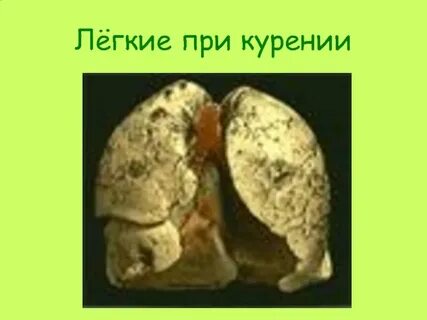 Длительное курение