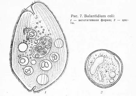 Balantidium coli