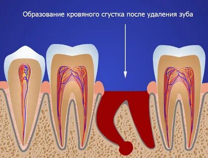 Можно ли удалить зуб если болит