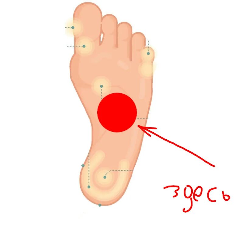 Середина стопы. Болит подошва стопы в середине. Болит стопа ноги по середине.