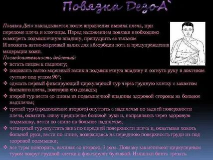 Повязка деза алгоритм