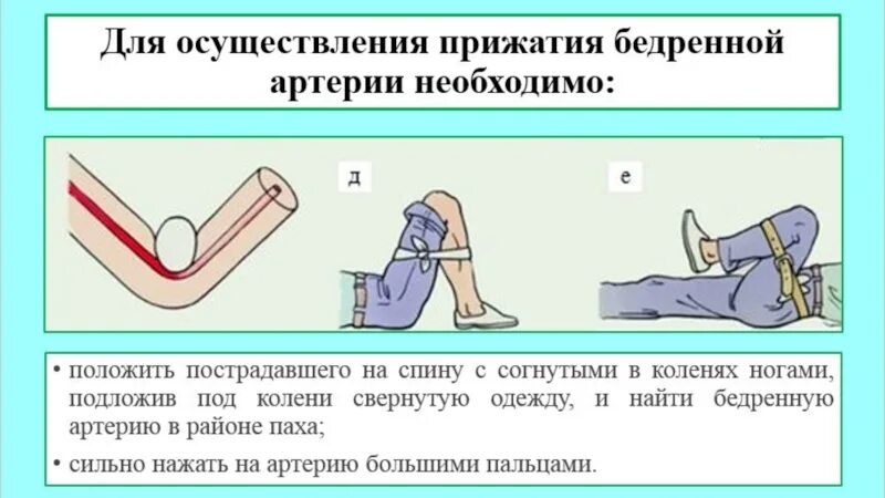 Алгоритм оказания первой помощи при бедренном кровотечении. Алгоритм 1 помощи при артериальном кровотечении. Алгоритм действий при кровотечении бедренной артерии. Алгоритм действий при повреждении бедренной артерии кровотечение.