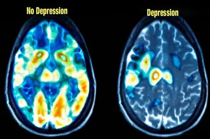 Как выглядит мозг здорового человека Curious Minds: Brain Health (2015)