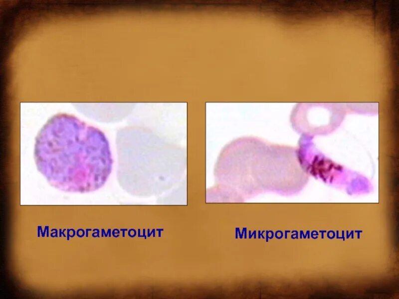 Микрогаметоцит это. Макрогаметоцит плазмодия. Микрогаметоцит малярийного плазмодия. Макрогаметоцит и микрогаметоцит. Макрогаметоцит малярийного плазмодия.