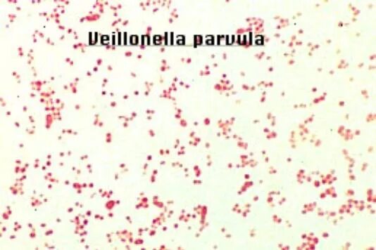 Veillonella spp в мазке у женщин. Вейлонелла микробиология. Veillonella spp в мазке у женщин. Вейлонелла микробиология. Вейлонеллы окраска по граму.