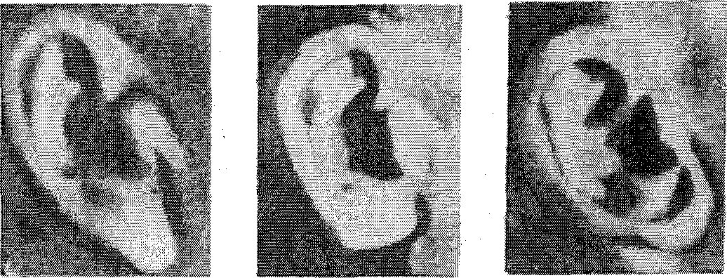 Ухо. Треугольная мочка уха. Треугольная мочка уха. Треугольная мочка уха. Строение ушной раковины габитоскопия.