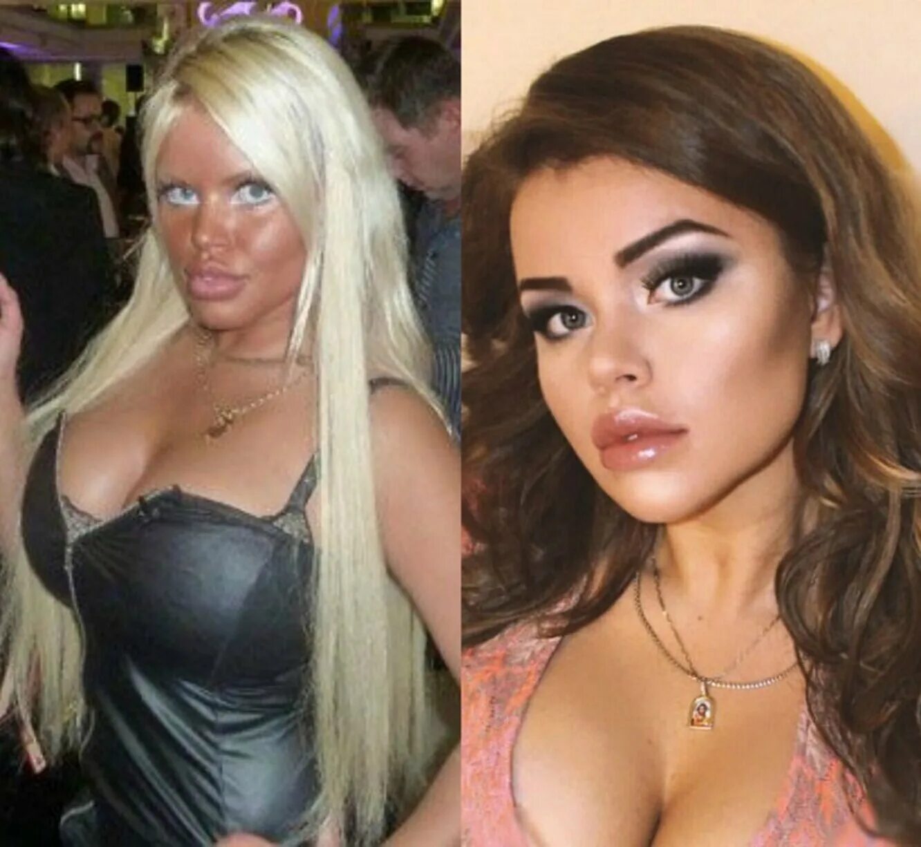Пластические операции звезд: удачные и не очень - BeautyHunter.ru