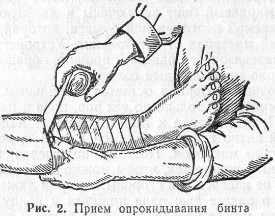 Хирургические перевязки. Перевязка ног перед операцией. Бинтование конечностей перед операцией. Бинтование ног перед операцией. Бинтование ноги после операции