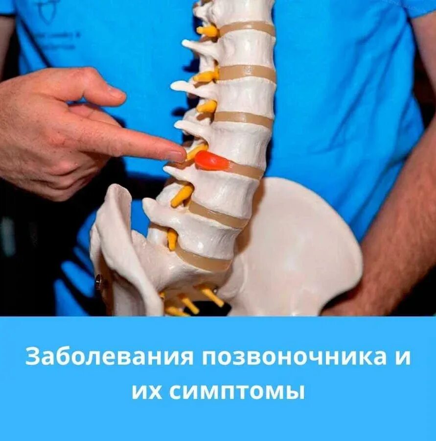 Позвоночника без грыжа как лечить. Заболевания позвоночника. грыжа позвоночника. болезни спины. грыжа позвоночника симптомы.