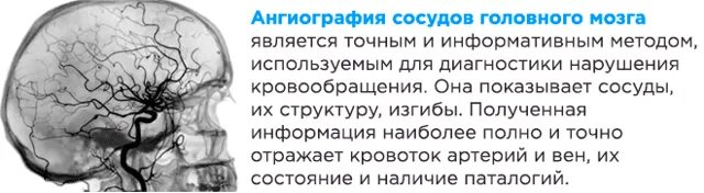 Отзывы сосудов головы