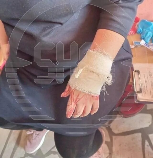 В школе порезали девочку