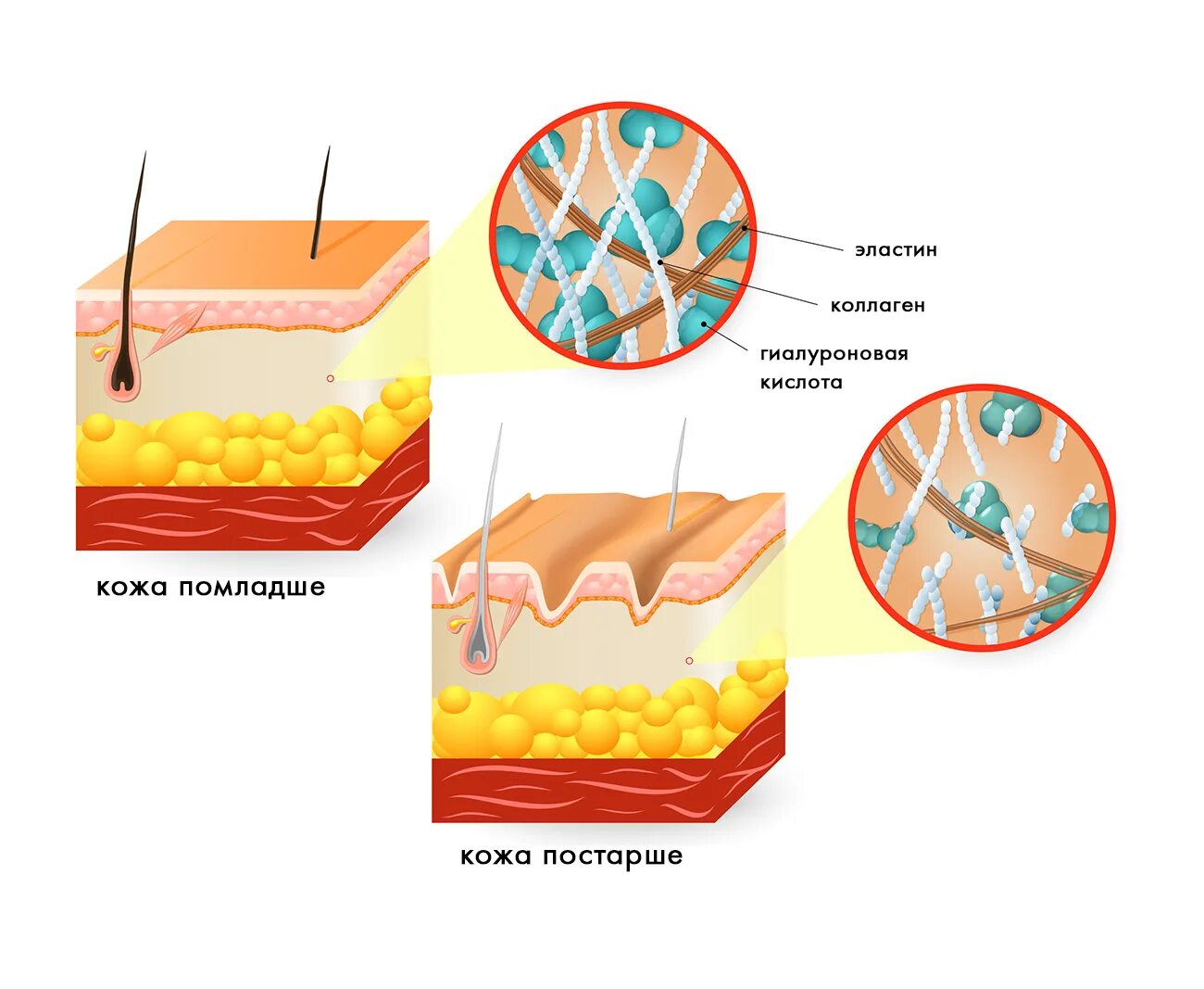 Как работает коллаген. Коллаген эластин фибробласты. Коллаген для кожи. Эластин и коллаген. Коллаген эластин гиалуроновая кислота.