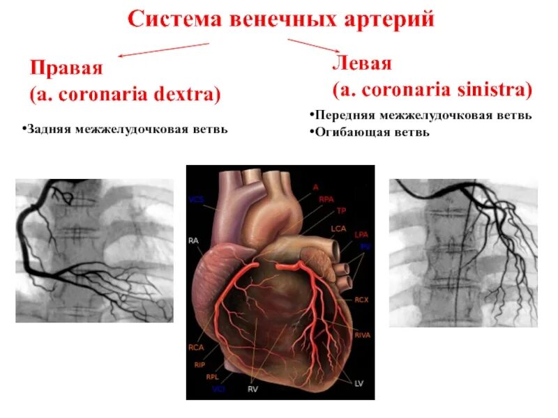 Коронарные венечные сосуды. Коронарография схема сосудов. Огибающая правой венечной артерии. Коронарные и венечные артерии сердца.