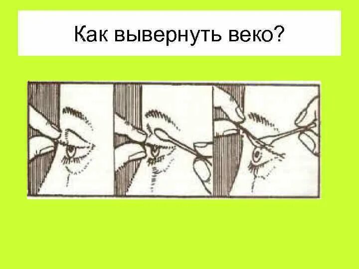 Как достать ресницу из верхнего века. Как достать ресницу из верхнего века