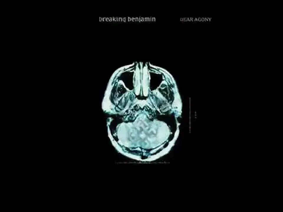 Breaking benjamin dear. Breaking benjamin dear agony. breaking benjamin dear agony album cover. breaking benjamin - dear agony (2009). without you breaking benjamin.