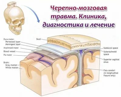 Код мкб черепно мозговая травма