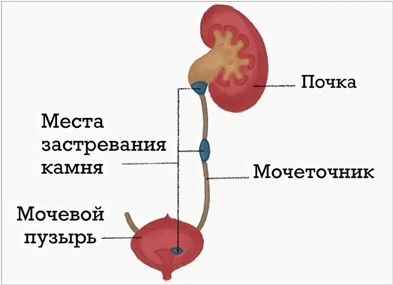 Первая помощь при почечной колике