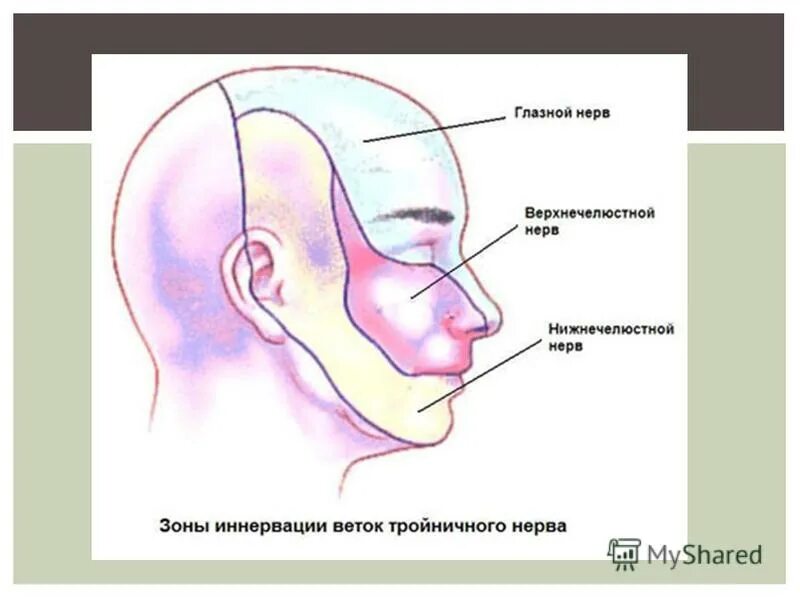 Зоны Зельдера тройничного нерва. Зоны иннервации тройничного нерва. Ветви тройничного нерва и зоны иннервации. Схема зон иннервации тройничного нерва.