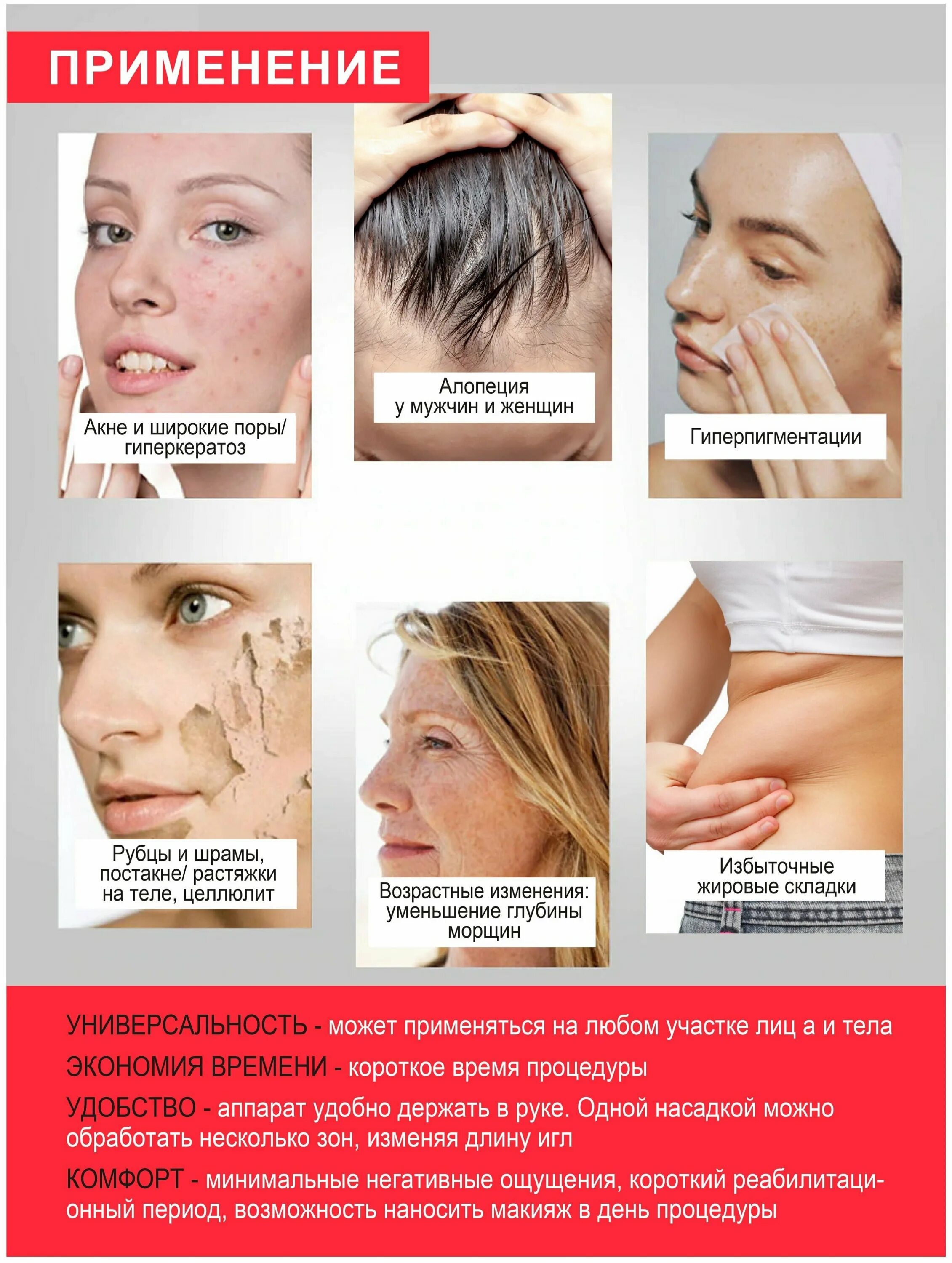 Дермапен отзывы о процедуре. Фракционная мезотерапия для лица реклама. Дермапен отзывы о процедуре. Дермапен отзывы о процедуре. Фракционная мезотерапия дермапен.