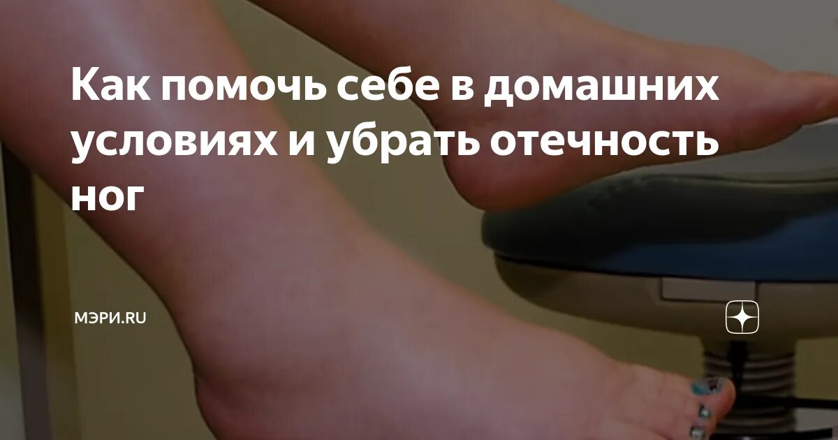 Почему после самолета отекаешь. Почему после самолета отекаешь