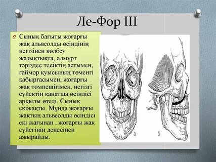 Мари Элдегі порно