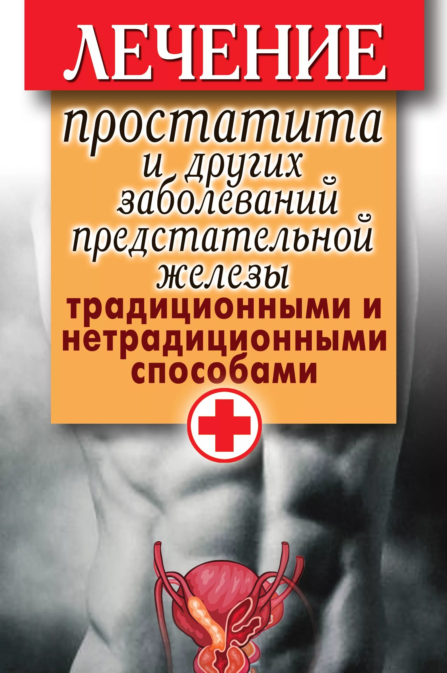 Инфекция простаты. Простатит лекарства. Лечебный простатит. Заболевание простатит. Болезни предстательной железы.