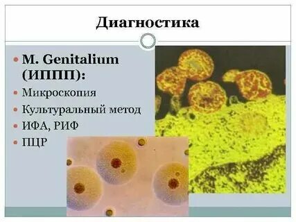 Микоплазмоз у женщин симптомы и причины