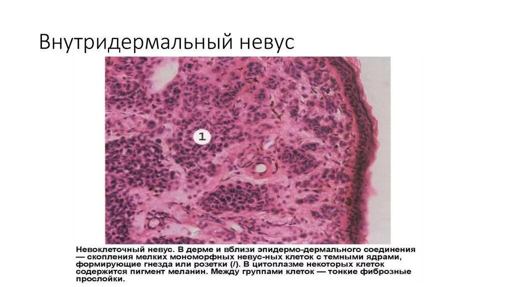 Папилломавирусная инфекция урогенитального тракта человека FedorovMedCenter.ru