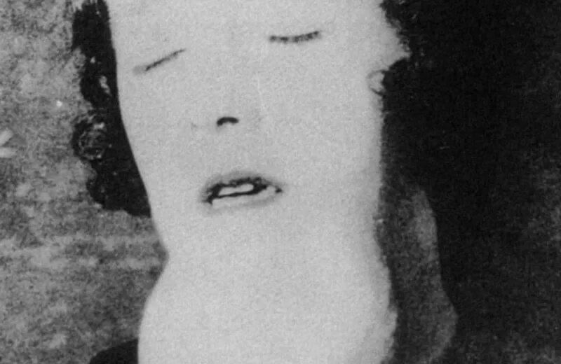 Дистальный прикус (птичий профиль). Радиевые девушки" (2018). Прогнатия и ретрогнатия. Кэтрин донахью радиевые девушки. Глубокий дистальный прикус профиль.