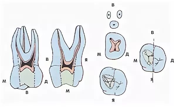 Анатомия каналов верхних моляров. Анатомия корневых каналов моляров верхней челюсти. Первый моляр верхней челюсти каналы. Анатомия корневых каналов первого моляра верхней челюсти.