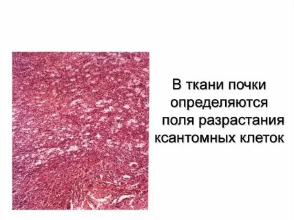 Почечная ткань