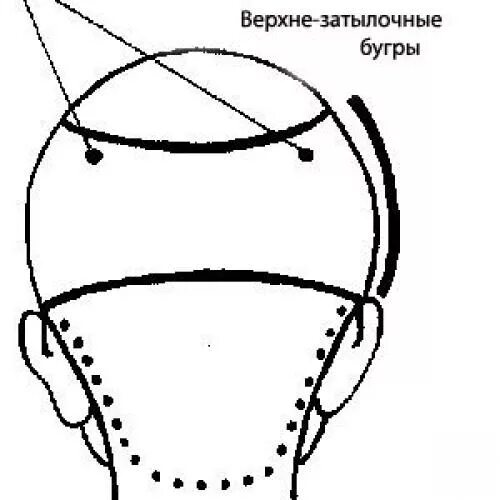 Затылок схема. Зоны головы затылочный бугор. Верхне затылочная зона волос схема. Схема теменная зона головы. Схема головы затылочный бугор.