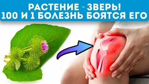 Лечение лопухом артроза коленного сустава