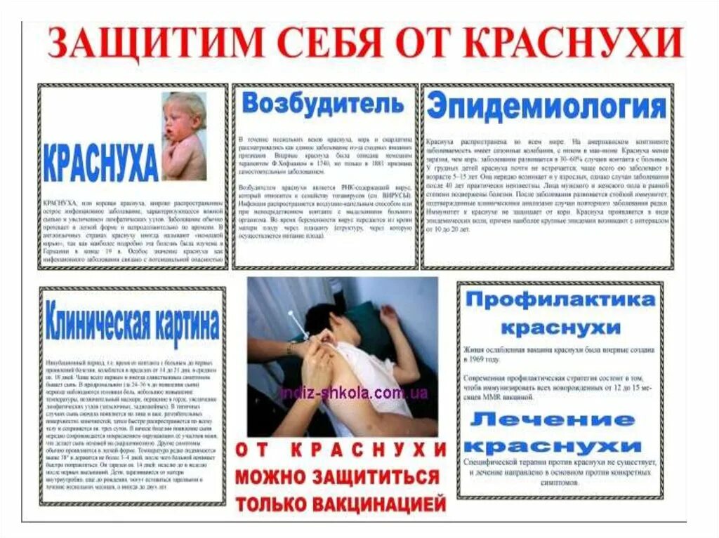 Санбюллетень краснуха у детей. Краснуха профилактика заболевания. Профилактика краснухи у детей. Краснуха у детей информация.