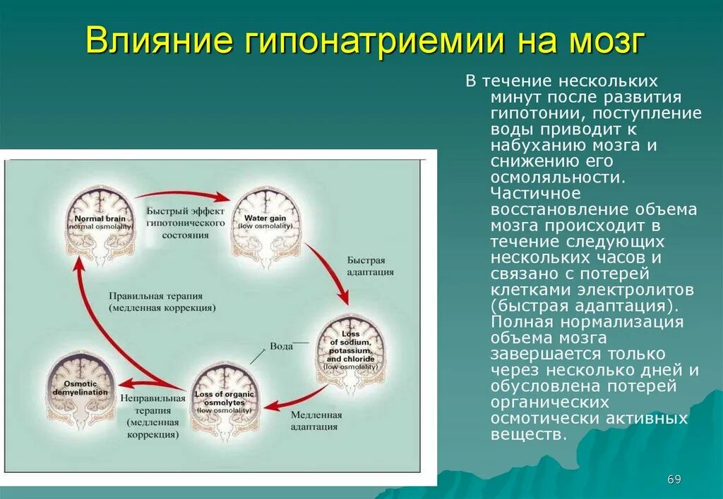 После минут. Коррекция гипонатриемии. Влияние воды на мозг. Гипонатриемия проявления. Гипонатриемия влияние.