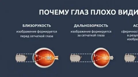 Глаз пл
