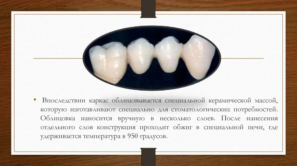 Металлокерамика этапы. Лабораторный этап изготовления коронки. Клинико лабораторные этапы литой коронки. Клинико-лабораторные этапы изготовления керамических виниров.. Лабораторные этапы металлокерамической коронки