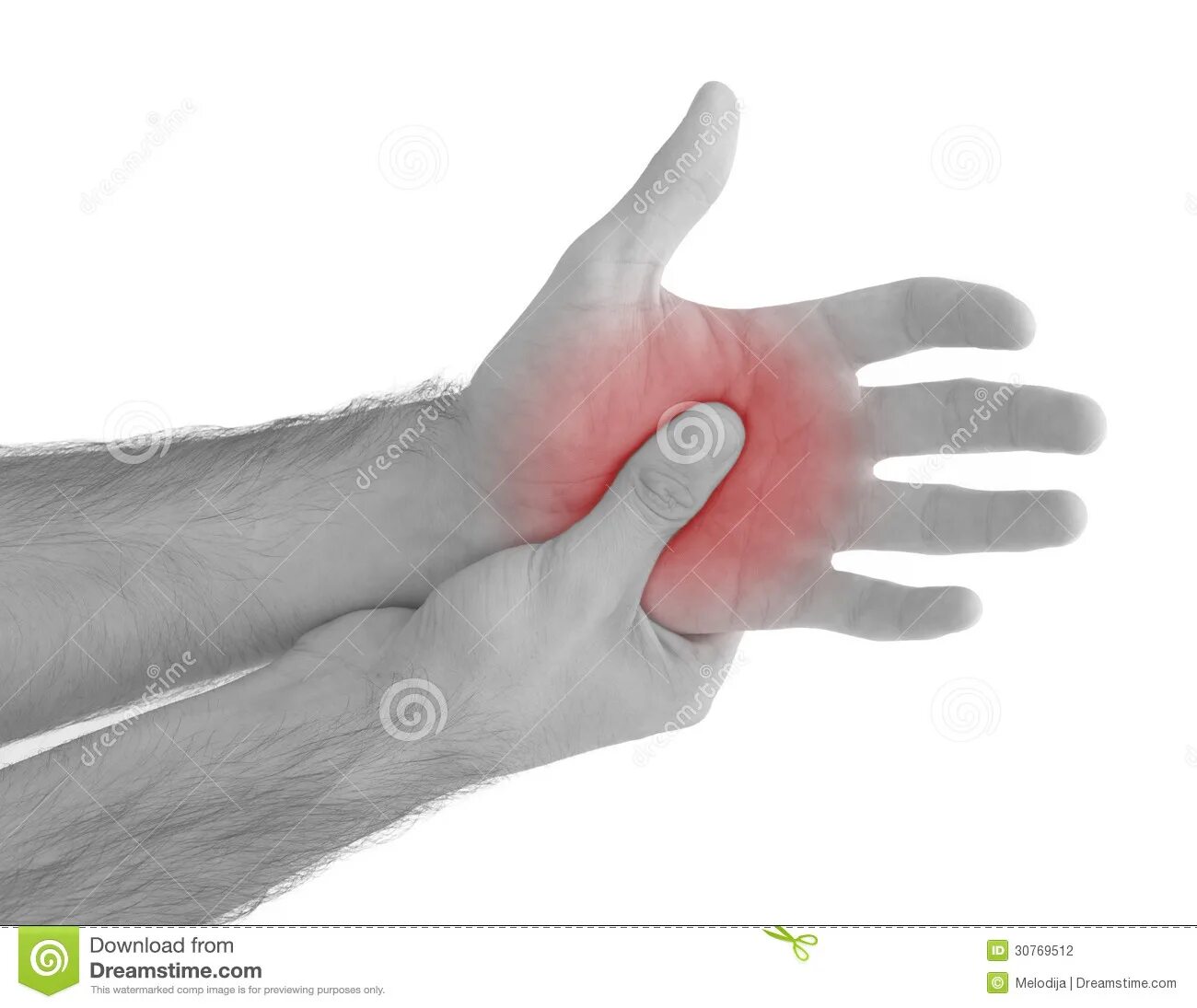 Бошь в правой ладони в середине. Резкая боль в ладони левой руки. Болит сустав большого пальца. Мышцы кисти анатомия таблица. Палец между средним и мизинцем.