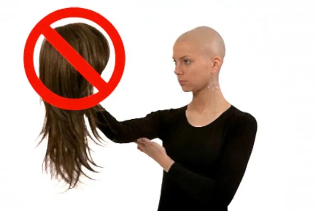 После химии выпадают. Волосы после химиотерапии. Выпадение волос после химиотерапии. После химиотерапии выпадают волосы. Алопеция после химиотерапии.