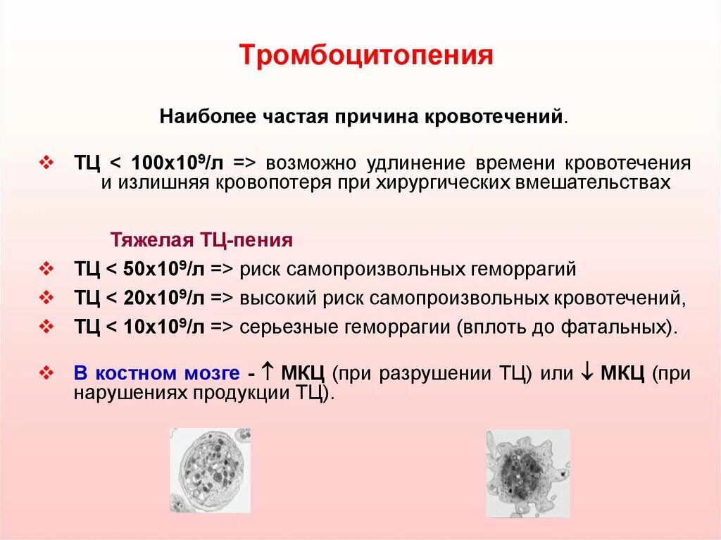 Тромбоцитопения что это такое. Тромбоцитопения причины. тромбоциты при вирусной инфекции. тромбоцитопения причины возникновения.