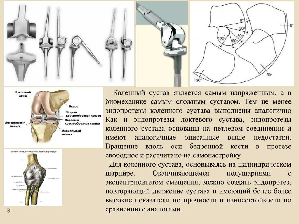 Эндопротез коленного сустава. Эндопротезирование коленного сустава топографическая анатомия. Одномыщелковый эндопротез коленного сустава. Эндопротез коленного сустава Stryker. Замена сустава осложнения