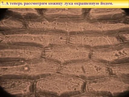 Кожицей начало 3