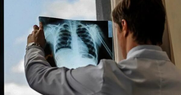 Делают рентген грудной клетки ребенку. Как часто можно делать рентген. Рентген грудной клетки как делают. Как делают рентген легких детям.