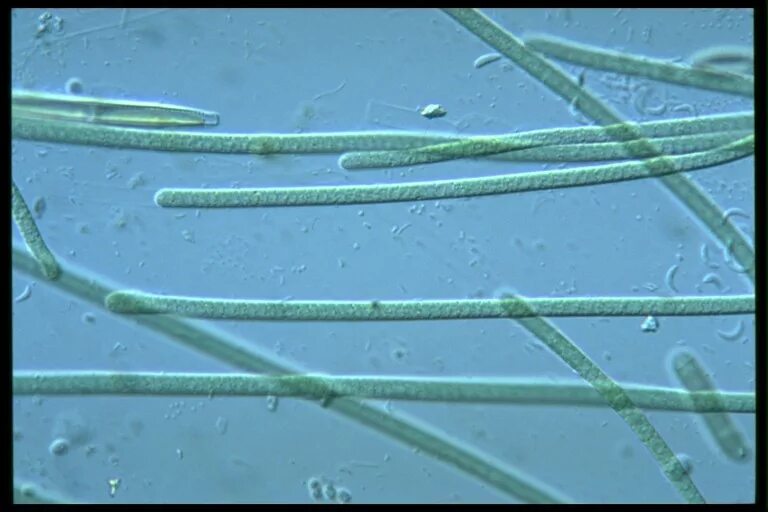 Cyanobacteria Lyngbya. Lyngbya limnetica. Lyngbya водоросль. Цианобактерии Nodularia. Гриб водоросль цианобактерия